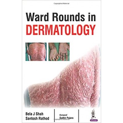 Ward Rounds in Dermatology;1st Edition 2017 By Bela J Shah & Santosh Rathod