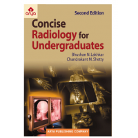 Concise Radiology for Undergraduates;2nd(Reprint) Edition 2022 by Bhushan N.Lakhkar & Chandrakant M.Shetty