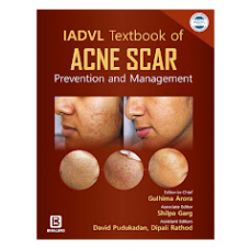 IADVL Textbook of Acne Scar Prevention and Management;1st Edition 2022 By Gulhima Arora