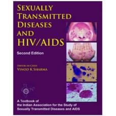 Sexually Transmitted Diseases And Hiv/Aids:2nd Edition 2009 By Vinod K Sharma