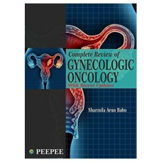 Complete Review of Gynecologic Oncology with Recent Updates;1st Edition 2020 By Sharmila Arun babu