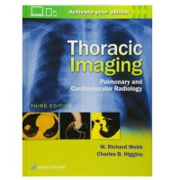 Thoracic Imaging: Pulmonary and Cardiovascular Radiology;3rd Edition 2017 By W.Richard Webb
