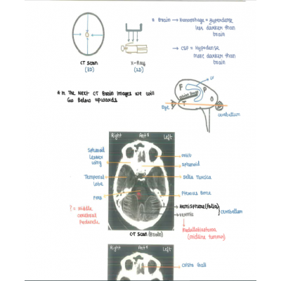 Radiology DAMS PG-Hand Written (Colored ) Notes 2022-23