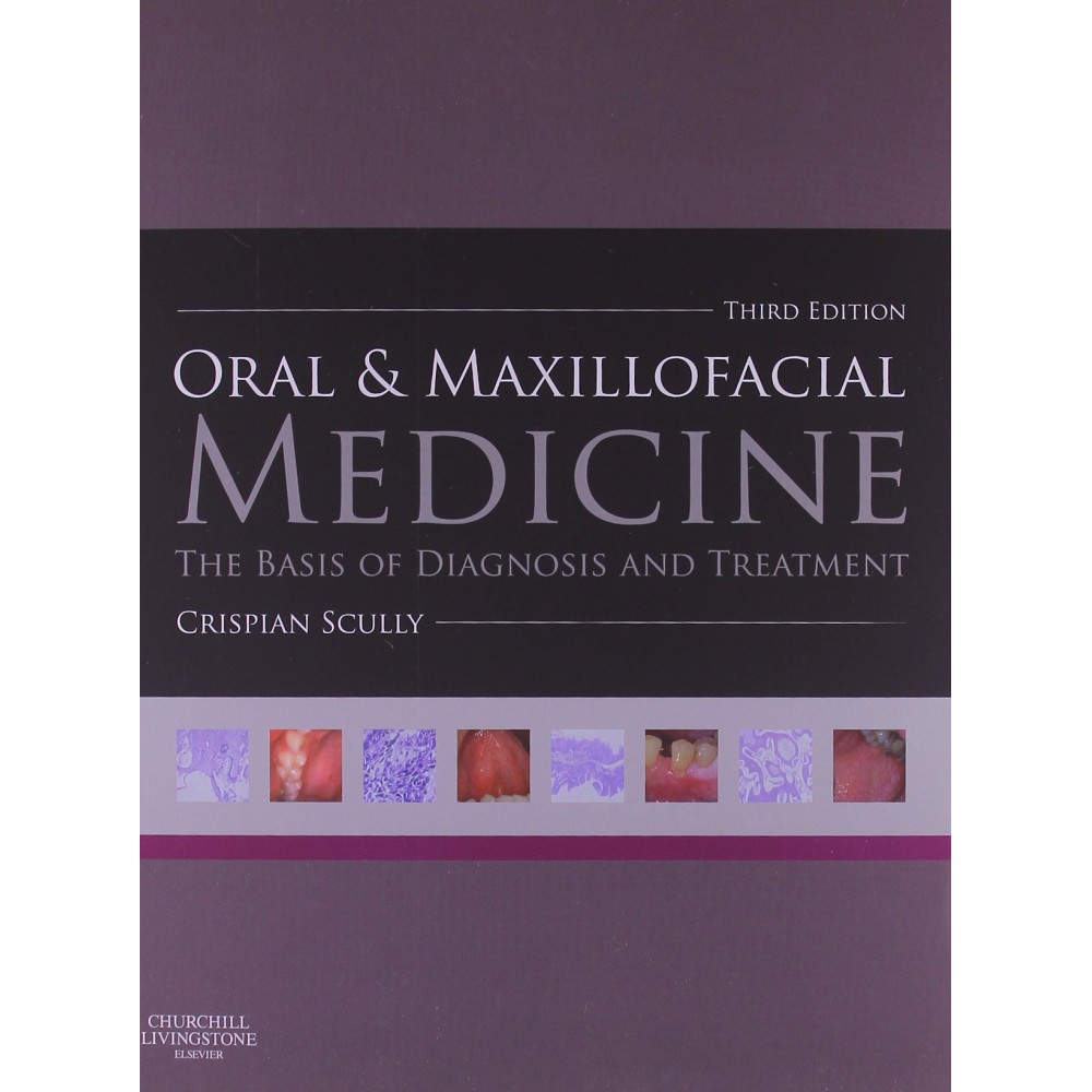 Oral and Maxillofacial Medicine:The Basis of Diagnosis and Treatment;3rd Edition 2013 By Crispian Scully