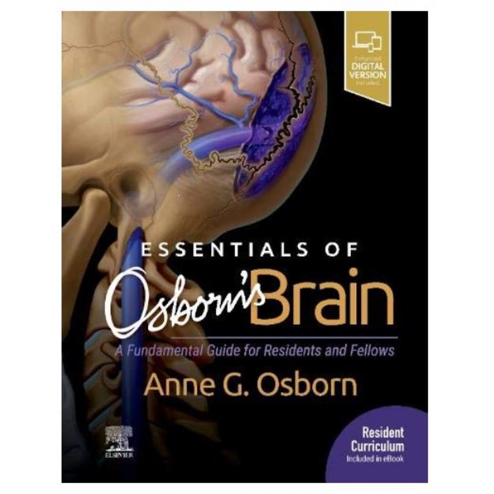 Essentials of Osborn's Brain: A Fundamental Guide for Residents and Fellows;1st Edition 2020 By Anne G. Osborn 
