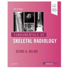 Fundamentals of Skeletal Radiology;5th Edition 2019 By Clyde A.Helms