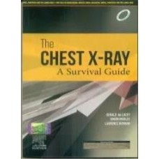  The Chest X-Ray A Survival Guide:1st Edition 2023 By Gerald de Lacey