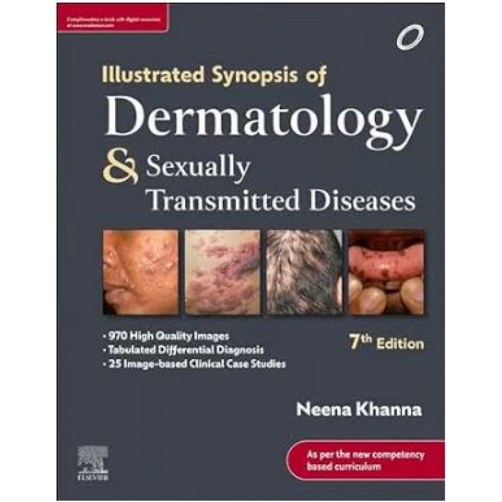 Illustrated Synopsis of Dermatology & Sexually Transmitted Diseases: 7th Edition 2023 By Neena Khanna