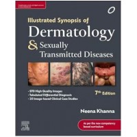 Illustrated Synopsis of Dermatology & Sexually Transmitted Diseases: 7th Edition 2023 By Neena Khanna