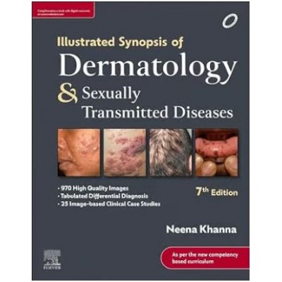 Illustrated Synopsis of Dermatology & Sexually Transmitted Diseases: 7th Edition 2023 By Neena Khanna