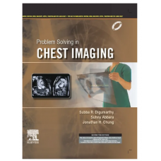 Problem Solving in Chest Imaging;1st Edition 2023 By Subba Digumarthy
