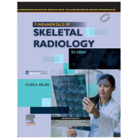 Fundamentals of Skeletal Radiology;5th (South Asia) Edition 2023 By Helms