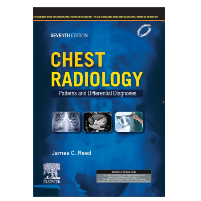 Chest Radiology Patterns and Differential Diagnoses;7th (South Asia) Edition 2023 By James Reed