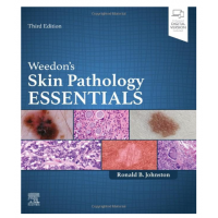 Weedon's Skin Pathology Essentials;3rd Edition 2023 by Ronald Johnston 