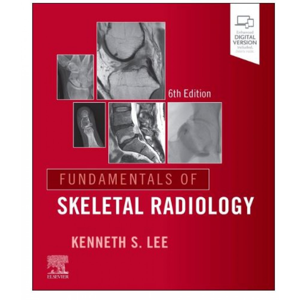 Fundamentals of Skeletal Radiology;6th Edition 2026 By Kenneth S Lee