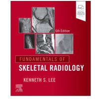 Fundamentals of Skeletal Radiology;6th Edition 2026 By Kenneth S Lee