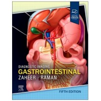 Diagnostic Imaging: Gastrointestinal;5th Edition 2025 By Siva P Raman & Atif Zaheer