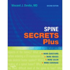 Spine Secrets Plus;2nd Edition 2011 By Vincent J. Devlin
