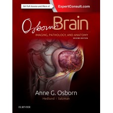 Osborn's Brain;2nd Edition 2017 By Anne G. Osborn,Gary Hedlund & Karen L. Salzman