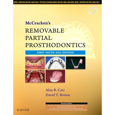 Mc Cracken's Removable Partial Prosthodontics;1st(South Asia) Edition 2016 By Carr