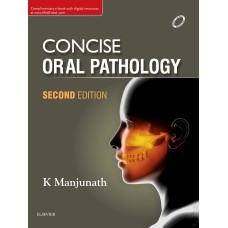 Concise Oral Pathology;2nd Edition 2017 By k  Manjunath