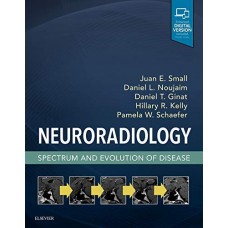 Neuroradiology:Spectrum and Evolution of Disease;1st Edition 2020 by Juan E. Small & Daniel L. Noujaim