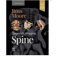 Diagnostic Imaging: Spine;4th Edition 2020 By Jeffrey S. Ross & Kevin R.Moore