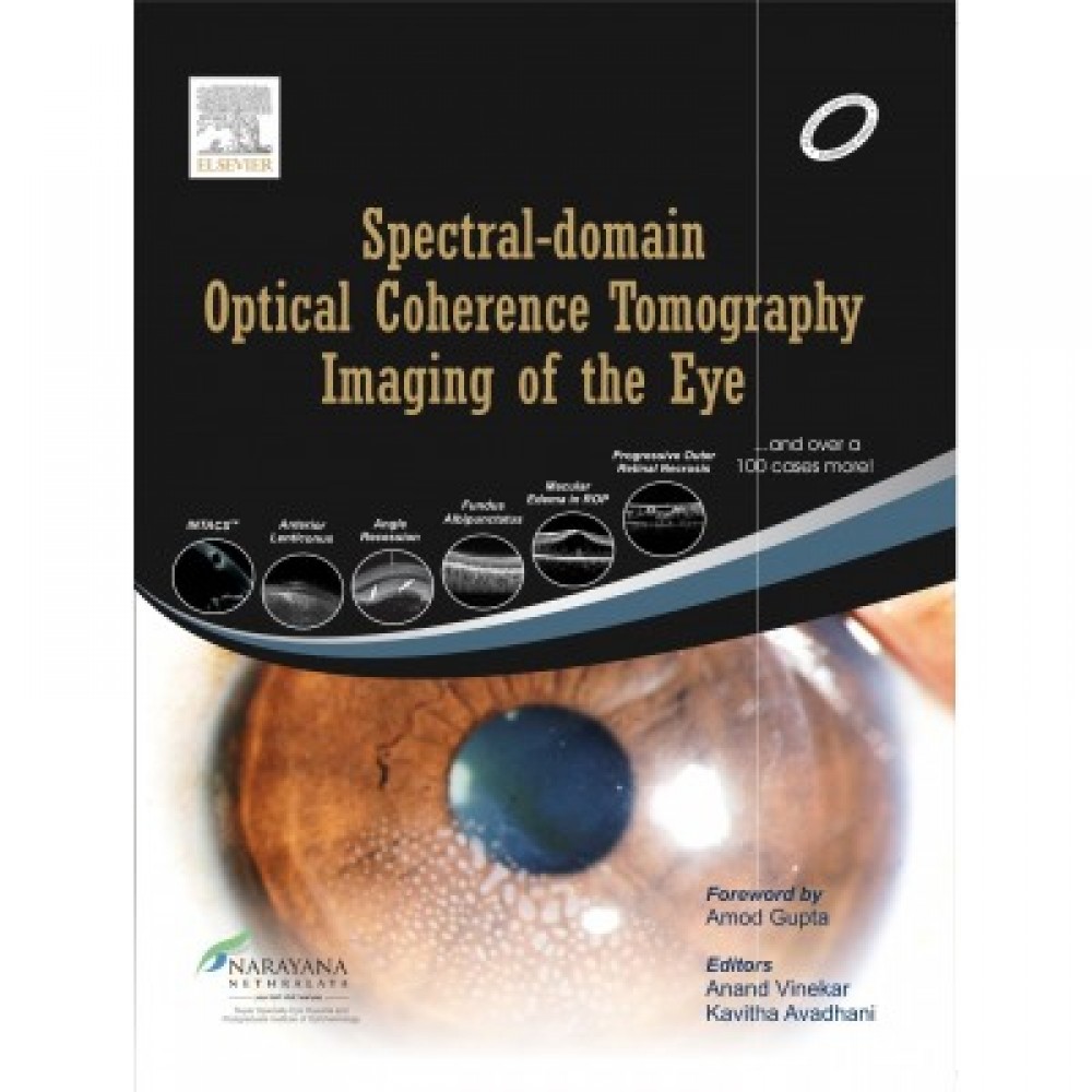 Spectral Domain Optical Coherence Tomography Imaging of the Eye;1st Edition 2013 by Anand Vinekar