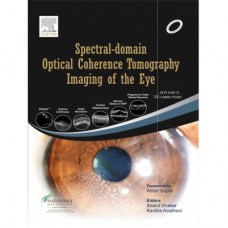 Spectral Domain Optical Coherence Tomography Imaging of the Eye;1st Edition by Anand Vinekar