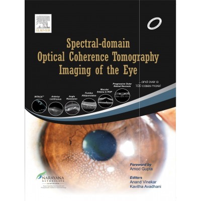 Spectral Domain Optical Coherence Tomography Imaging of the Eye;1st Edition 2013 by Anand Vinekar