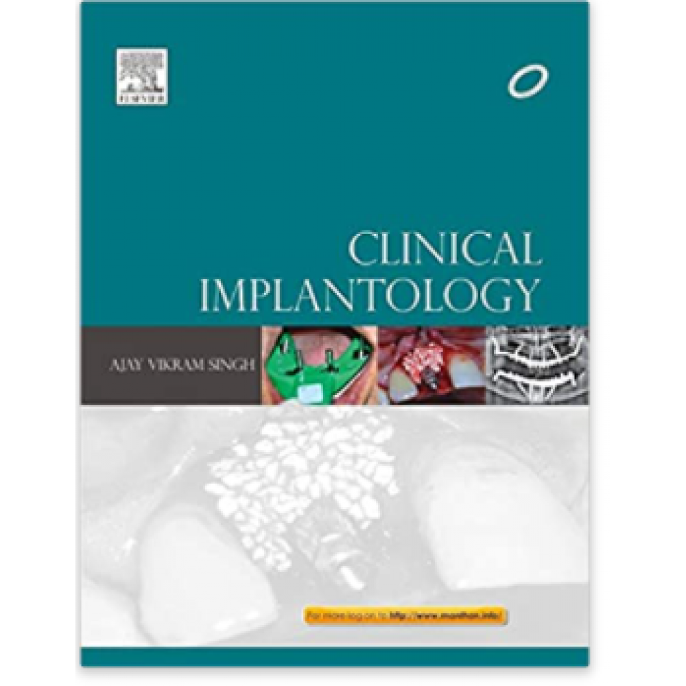 Clinical Implantology;1st Edition 2013 By Ajay Vikram Singh