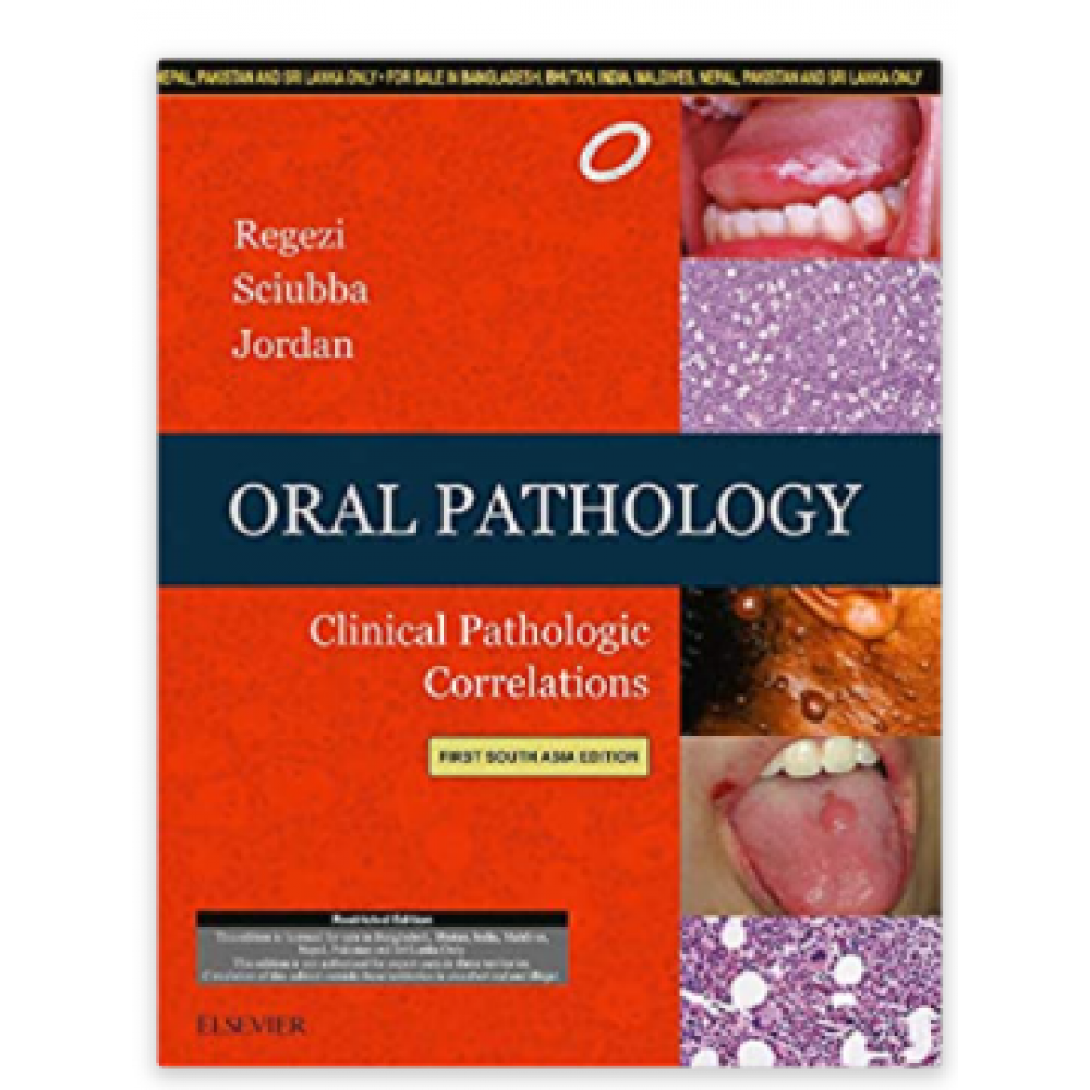 Oral Pathology: Clinical Pathologic Correlations; 1st (South Asia Edition) 2016 By Regezi