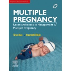 Multiple Pregnancy Recent Advances in Management of Multiple Pregnancy;1st Edition 2018 By Thiran D Dias & Amarnath G Bhide