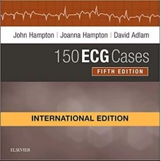 150 ECG Cases;5th(International)Edition 2019 By John Hampton