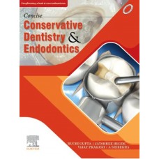 Concise Conservative Dentistry and Endodontics;1st Edition 2019 By Ruchi Gupta, Jayshree Hegde, Vijay Prakash & A.Srirekha