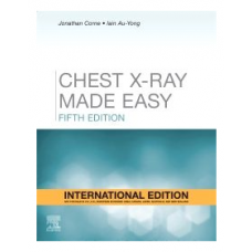 Chest X-Ray Made Easy;5th(International)Edition 2022 By Jonathan Corne