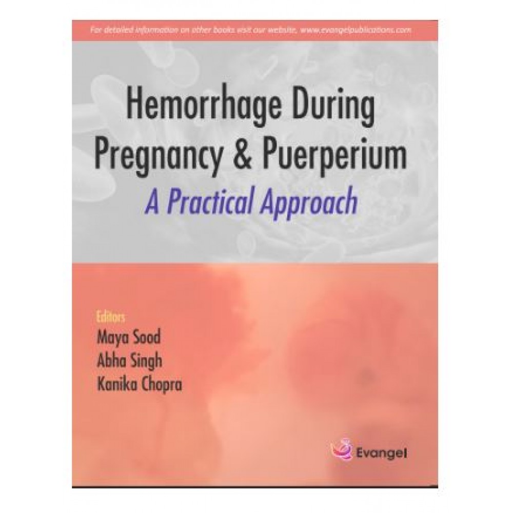 Hemorrhage During Pregnancy & Puerperium: A Practical Approach;1st Edition 2026 by Maya Sood, Abha Singh & Kanika Chopra