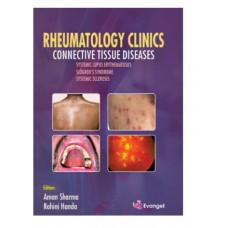 Rheumatology clinics Connective Tissue Diseases;1st Edition 2025 by Aman Sharma & Rohini Handa