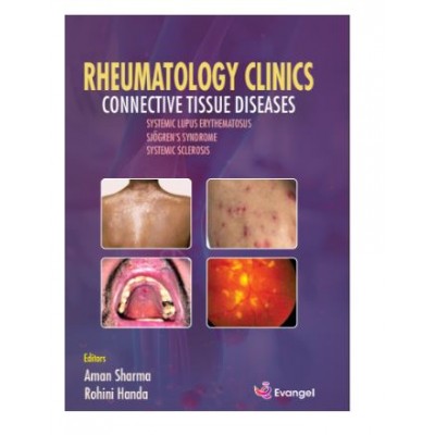 Rheumatology clinics Connective Tissue Diseases;1st Edition 2025 by Aman Sharma & Rohini Handa