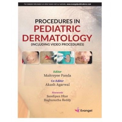 Procedures in Pediatric Dermatology;1st Edition 2026 by Maitreyee Panda