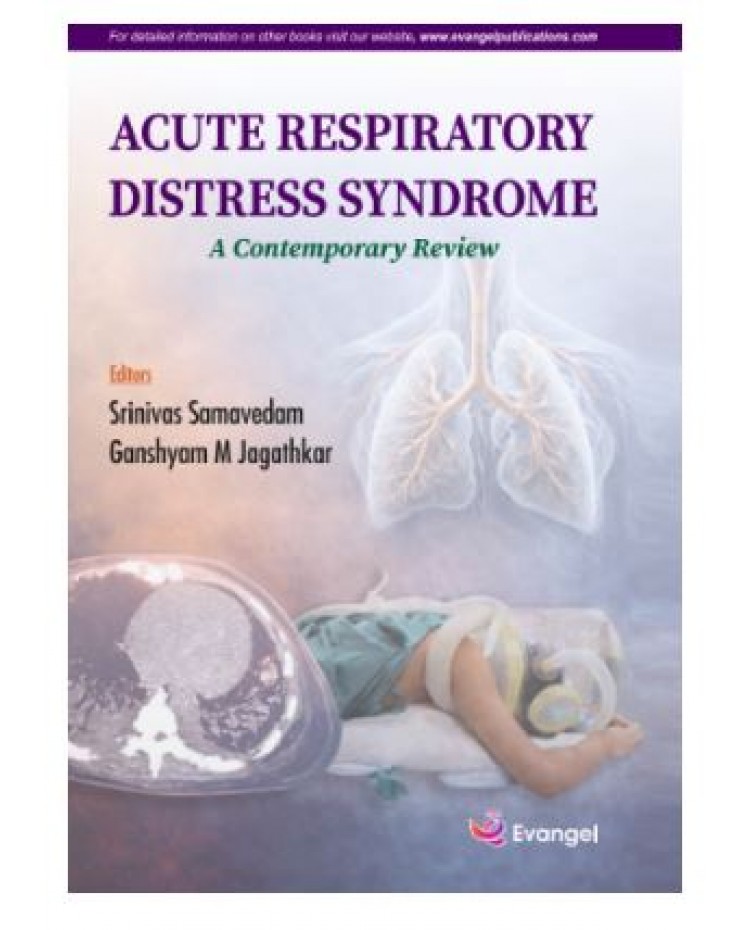Acute Respiratory Distress Syndrome A Contemporary Review;1st Edition 2026 by Srinivas Samavedam & Ganshyam M Jagathkar