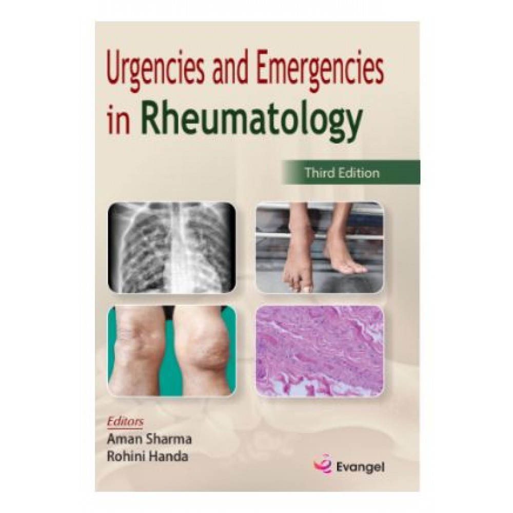 Urgencies And Emergencies In Rheumatology;3rd Edition 2026 By Aman Sharma & Rohini Handa