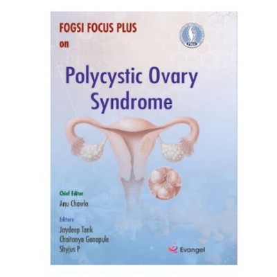 FOGSI Focus Plus on Polycystic Ovary Syndrome;1st Edition 2026 by Anu Chawla, Jaydeep Tank & Chaitanya Ganapule