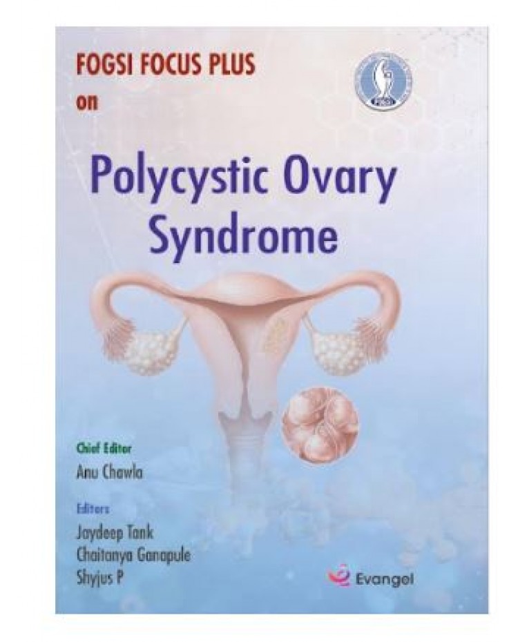 FOGSI Focus Plus on Polycystic Ovary Syndrome;1st Edition 2026 by Anu Chawla, Jaydeep Tank & Chaitanya Ganapule