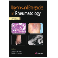 Urgencies And Emergencies In Rheumatology;2nd Edition 2021 By Aman Sharma & Rohini Handa