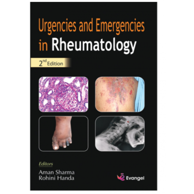 Urgencies And Emergencies In Rheumatology;2nd Edition 2021 By Aman Sharma & Rohini Handa