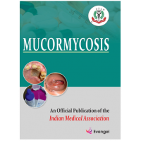 Mucormycosis:(An official publication of IMA);1st Edition 2021 by  Jyotirmoy Pal, Nandini Chatterjee, Bibhuti Saha