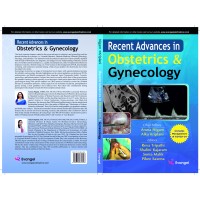 Recent Advances in Obstetrics & Gynecology;1st Edition 2021 By Aruna Nigam & Alka Kriplani
