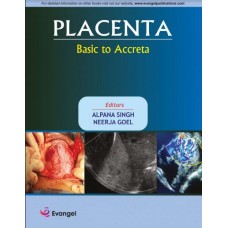 Placenta Basic to Accreta;1st Edition 2020 by Alpana Singh & Neerja Goel