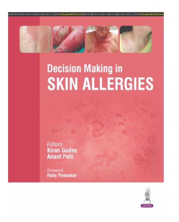 Decision Making in Skin Allergies;1st Edition 2025 by Kiran Godse & Anant Patil